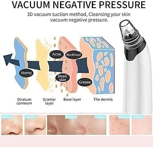 Rechargeable Face Vacuum Comedo Extractor Tool for Blackhead Whitehead Acne Removal