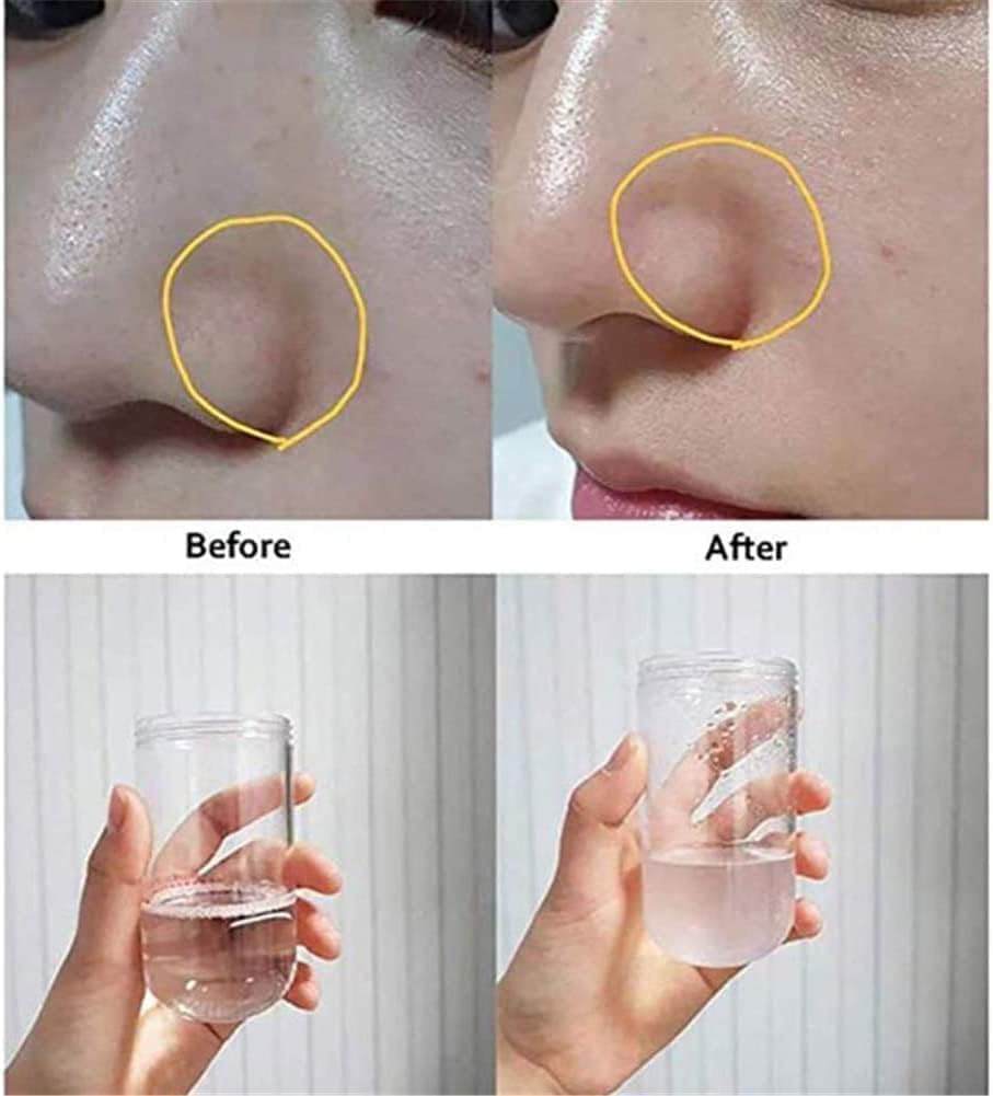 Water Oxygen Jet Beauty Machine, Bubble Oxygen Face Skin Care Machine, Multifunctional Vacuum Facial Deep Clean Hydrodermabrasion Machine for Home or SPA Salon.