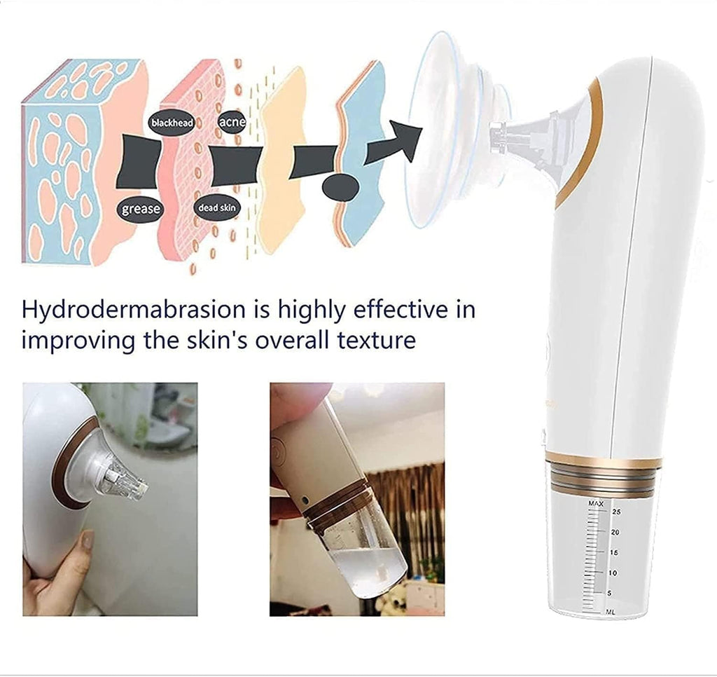 Blackhead Remover Pore Vacuum Cleaner, Electric Small Bubble Water Cycle Face Acne Comedo Extractor Tool Suction Beauty Device, USB Charging for Skin Ideal Gift