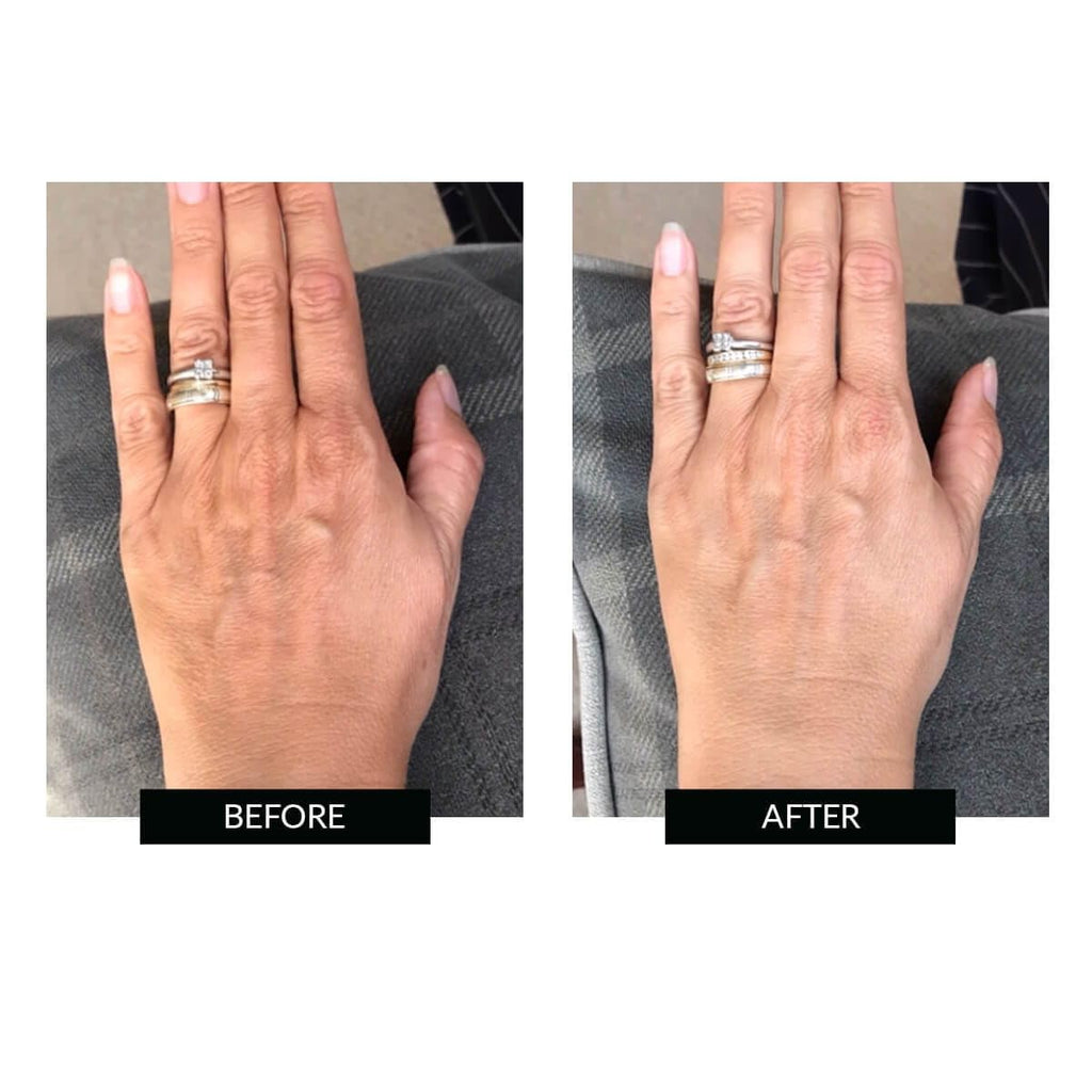 CurrentBody Skin LED Hand Perfector | Red Light Therapy Device for Wrinkle Reduction and Anti-Aging for Hands | Reduce Fine Lines, Wrinkles, Hyperpigmentation and Age Spots