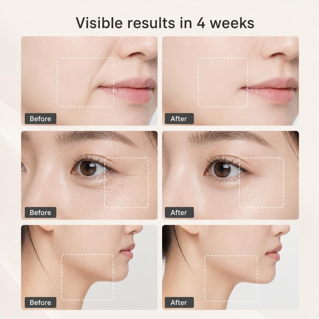 Surgia Pro Korean 4 in 1 Beauty Device - Facial Device, Face Lifting, Pore Care, Collagen Care, V Line Care, Facial Massager, Home Skincare Device, Skin Boost Device