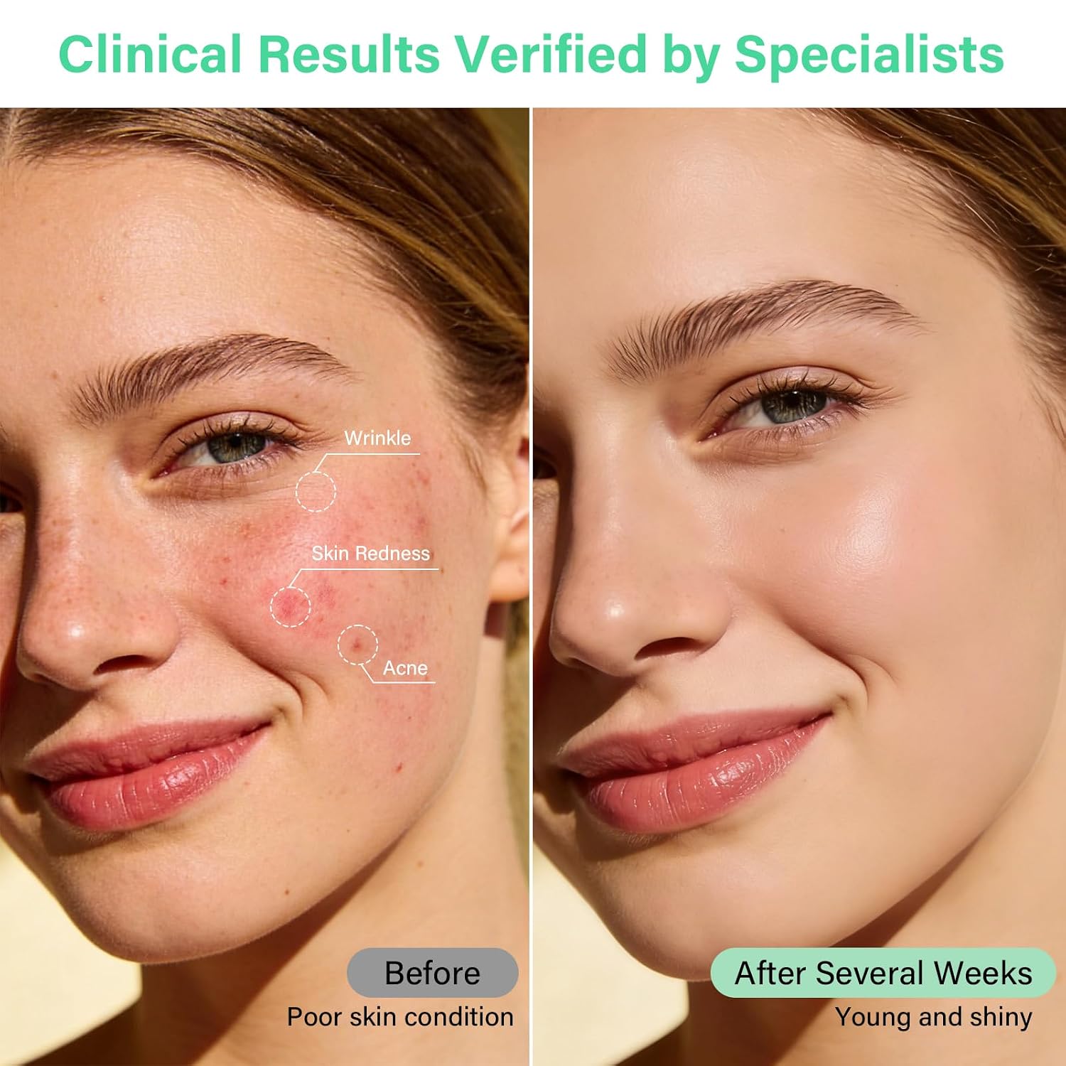 LED Face Mask Light Therapy with Neck, 7-Color Skin Care Mask for Home Use, Red 630±5nm & Near Infrared 830nm, Helps Reduce Wrinkles & Inflammatory Acne（Green）