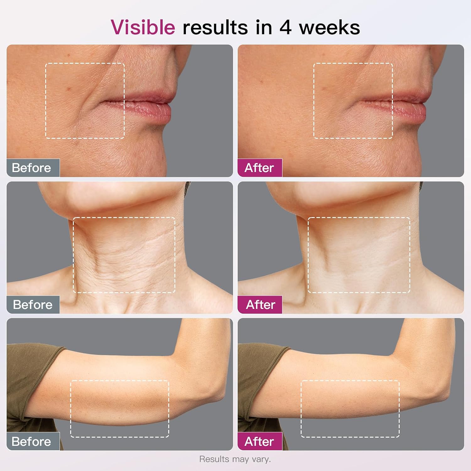 Microcurrent Facial Device 4-in-1 Beauty Device with Red Light Therapy and Blue Light Therapy for Neck & Face & Body Skincare Facial Device FDA-Cleared
