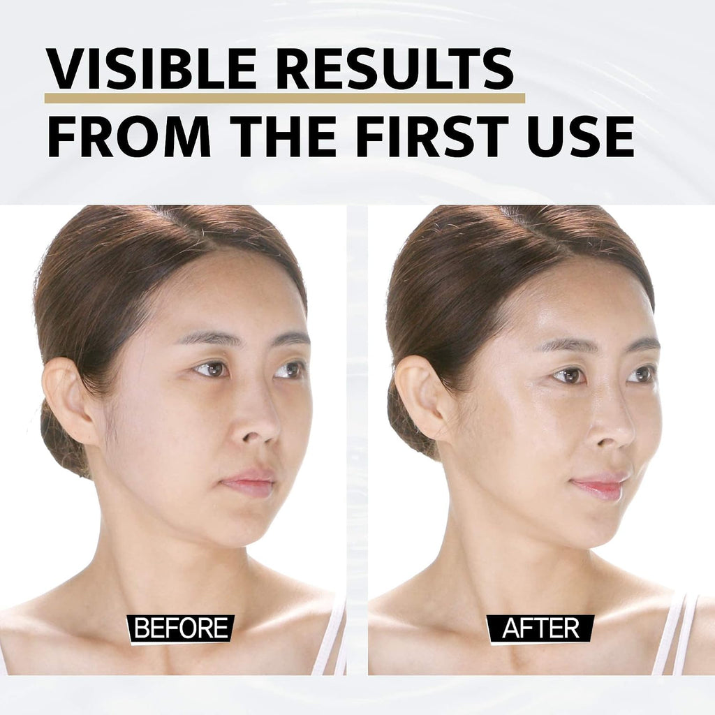 DOCTORCOS Super Lifting Skin Mask Set | Silicone Mask (Reusable) + Aqua Glow Mask (3.71 oz) + Fill up Wrinkle Cream (1.69 oz) | Full face Lifting Package | Neck and eye lift | Korean Skin Care