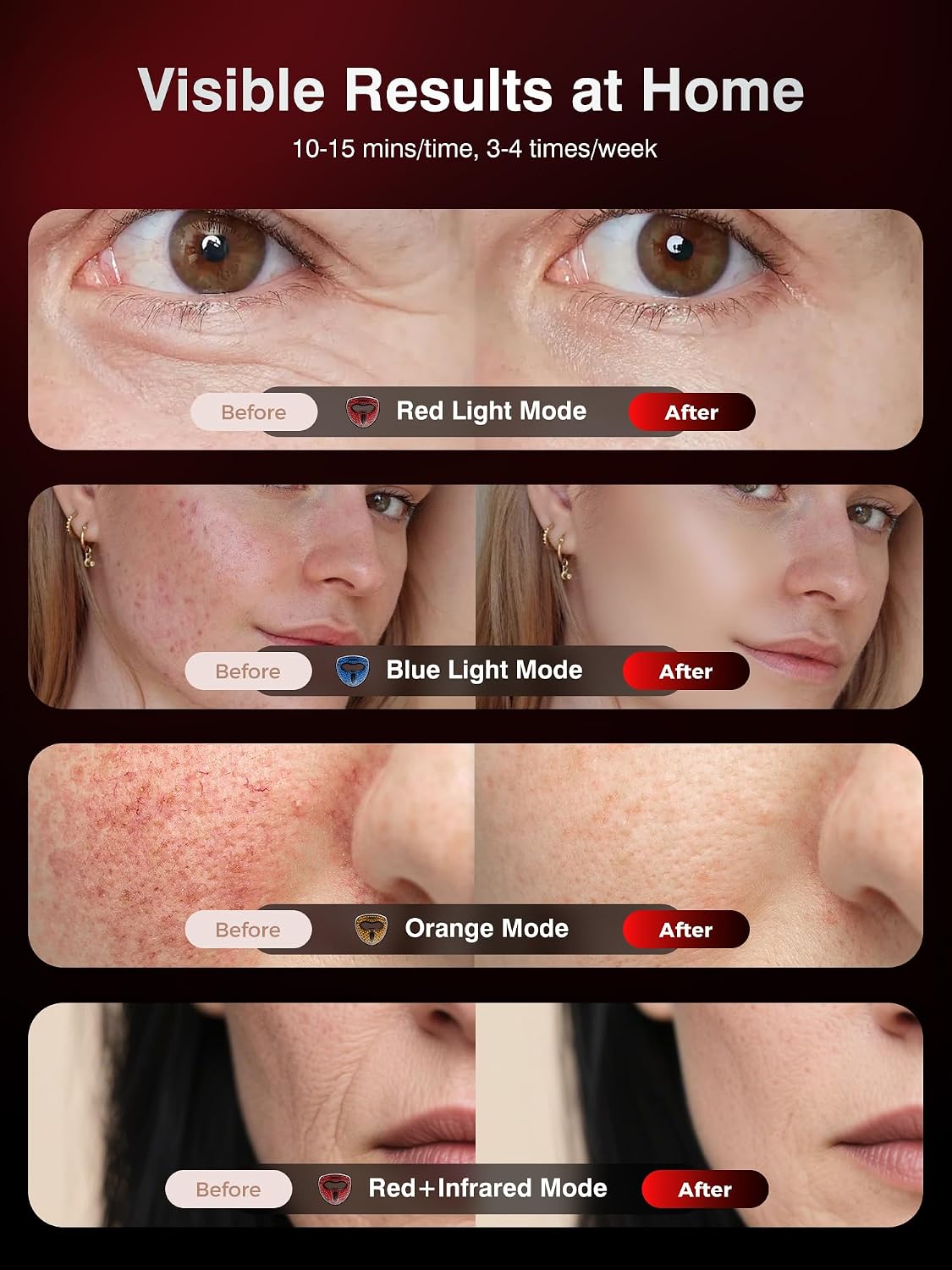 4D Wireless Red Light Therapy for Face, 328 LEDs 4 Modes LED Face Mask for Youthful Skin, 4000mAh 4Hours Rechargeable Smart Remote, Eye Protection, Skincare Wrinkles, Fine Lines, Dark Spots for Women