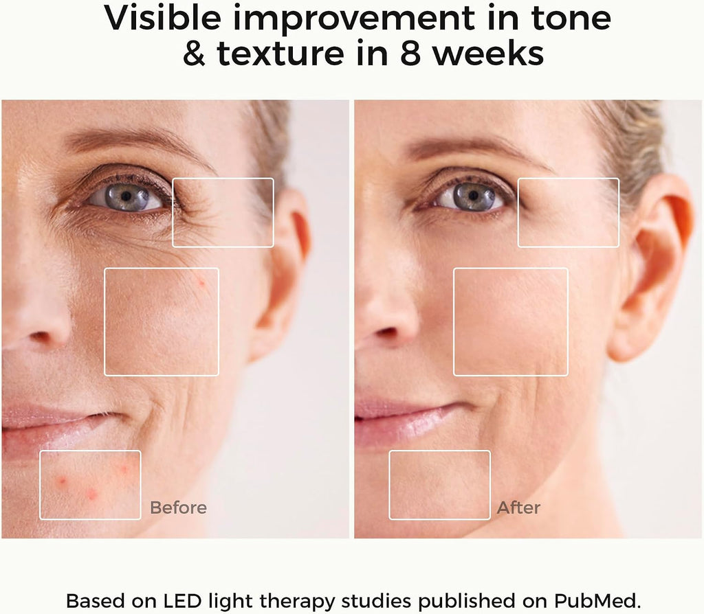 ARIVEA Red Light Therapy Mask for Face – Infrared Wireless LED Face Mask with 3 Modes, Portable Cordless Anti-Aging Light Therapy for Wrinkle Reduction, Acne Care & At-Home Skin (White)