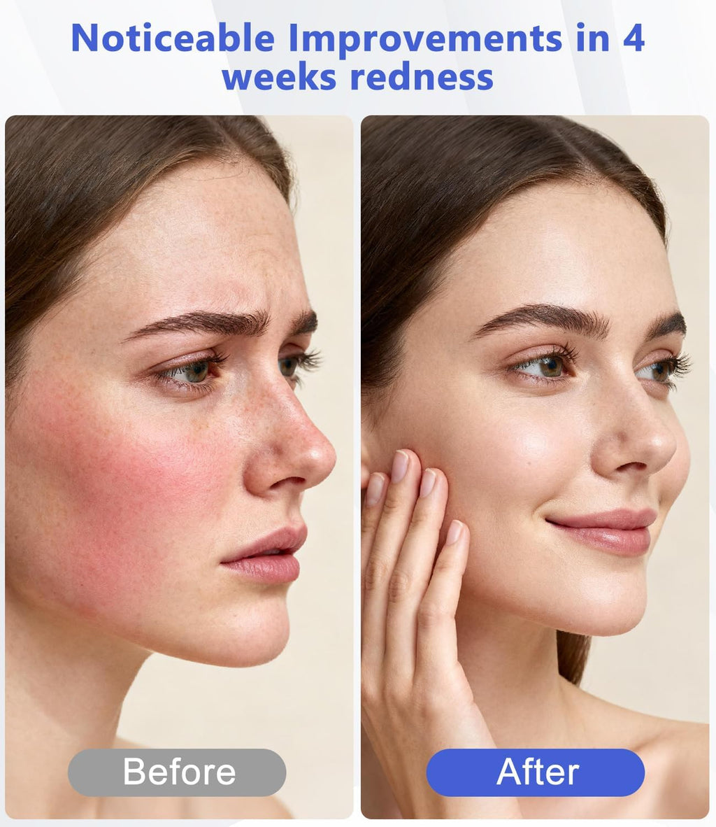 LED Light Therapy Machine FDA Cleared Red, Infrared and Blue Light Therapy, LED Face Mask Light Therapy Skin Care Photon Device for Wrinkle Reduction and Acne, G3
