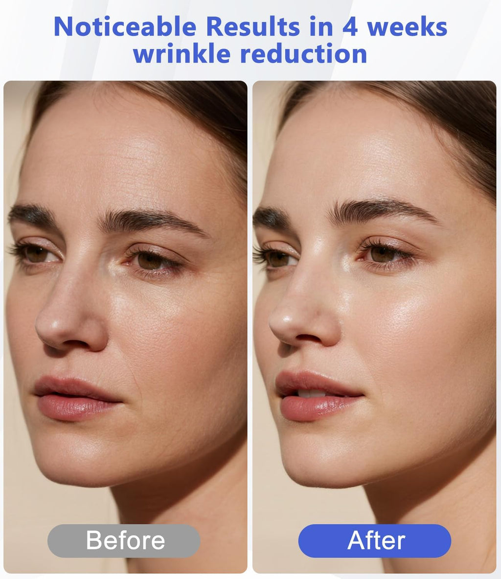 LED Light Therapy Machine FDA Cleared Red, Infrared and Blue Light Therapy, LED Face Mask Light Therapy Skin Care Photon Device for Wrinkle Reduction and Acne, G3