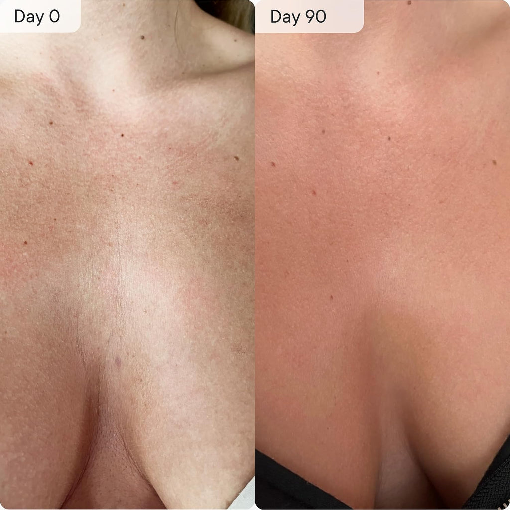 Qure Neck, Décolletage, Chest LED System, Red Light Therapy, 2 Wavelengths Red 633nm and Near-Infrared 830nm