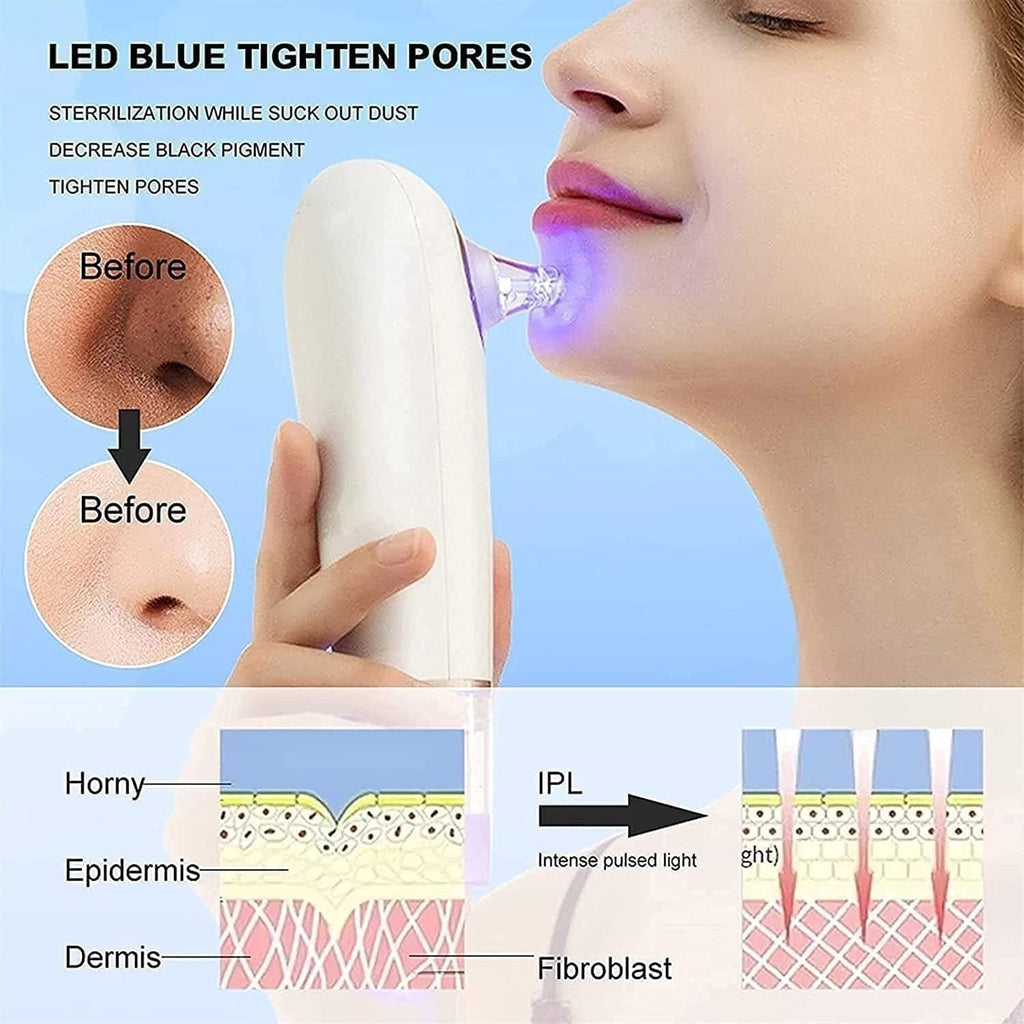 Blackhead Remover Pore Vacuum Cleaner, Electric Small Bubble Water Cycle Face Acne Comedo Extractor Tool Suction Beauty Device, USB Charging for Skin Ideal Gift
