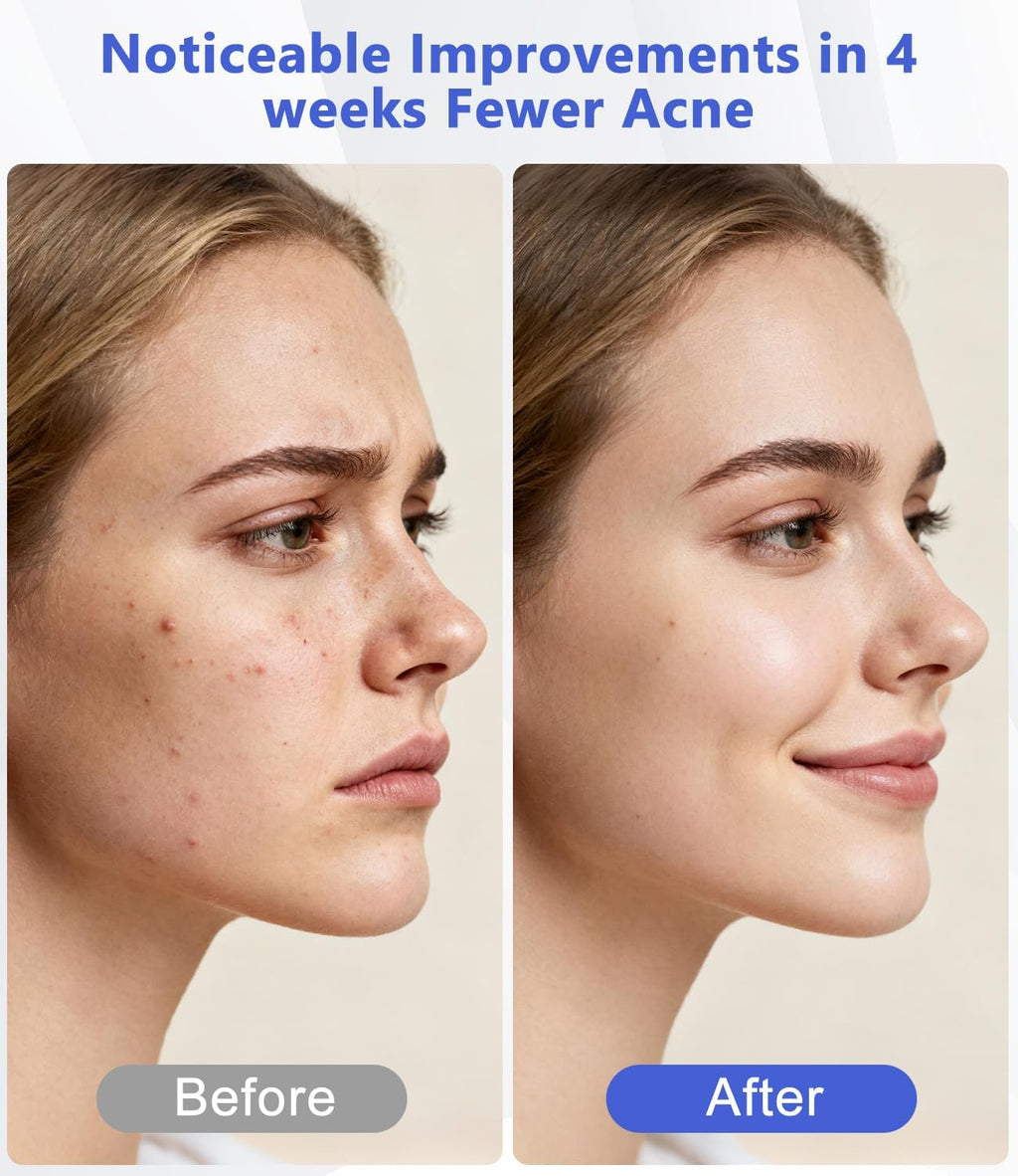 LED Light Therapy Machine FDA Cleared Red, Infrared and Blue Light Therapy, LED Face Mask Light Therapy Skin Care Photon Device for Wrinkle Reduction and Acne, G3