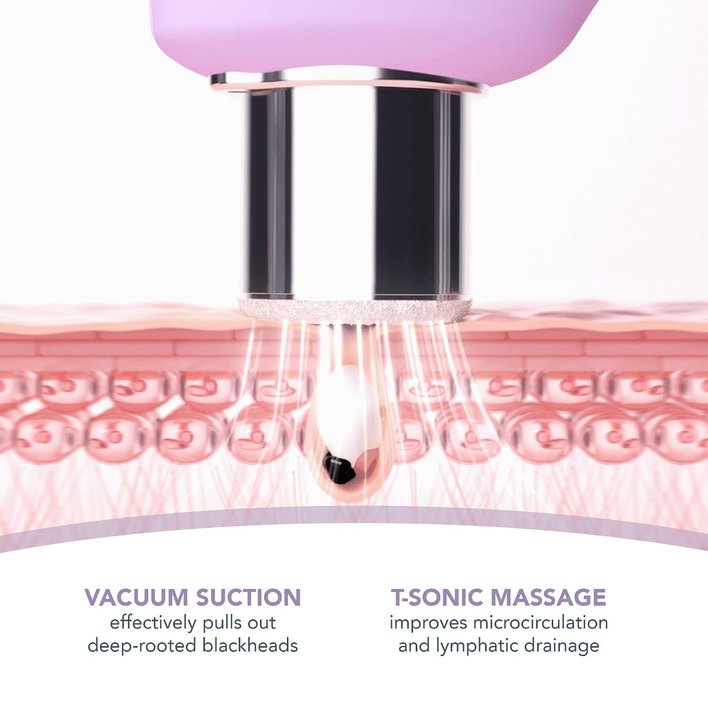 FOREO Smooth & Resurface KIWI derma Microdermabrasion Machine - Black Head Remover for Face + KIWI Active Pore & Blackhead Mask, 100g - Blackhead Extractor - No Pore Strips Suction Blackhead Remover