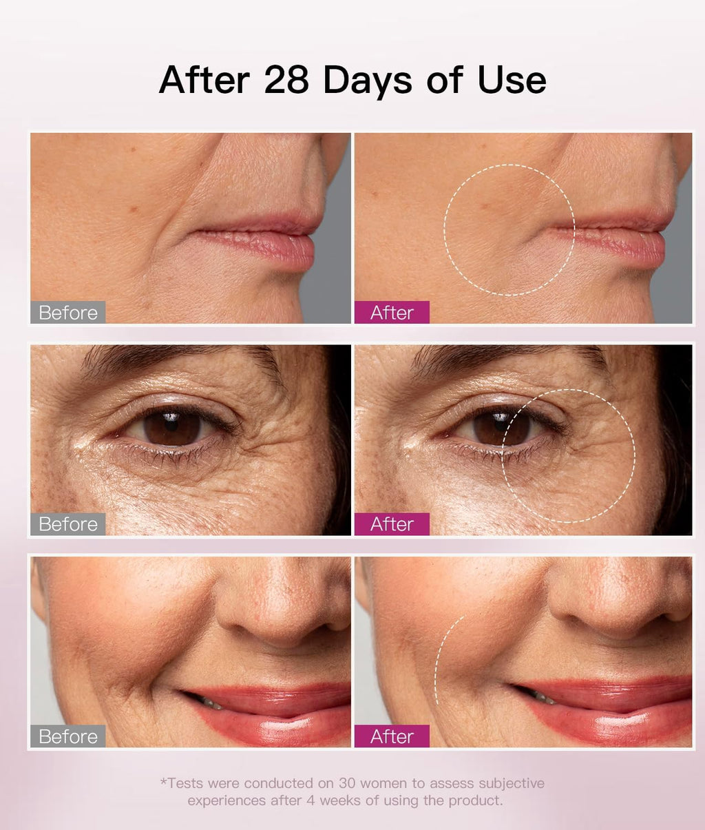 Microcurrent Facial Device, Facial Sculpting Tool for Instant Lift & Contour, 6-Point Skin Tightener for Eye Puffiness, Forehead Lines & Jawline, Anti-Aging Face Massager Kit