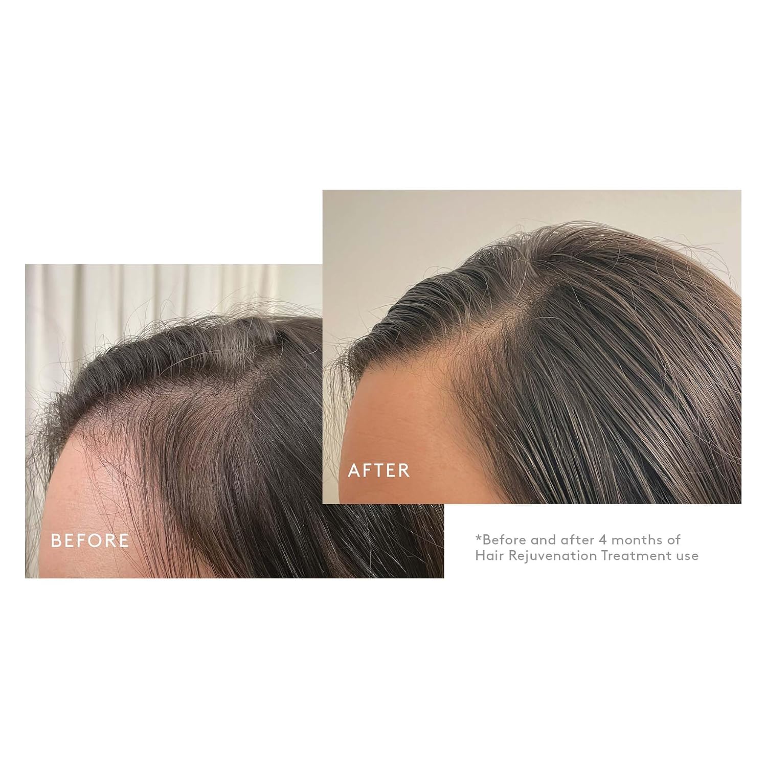 Virtue Flourish Shampoo, Conditioner and Density Booster Treatment Bundle for Thinning Hair for Women, 100% Drug-Free Regimen