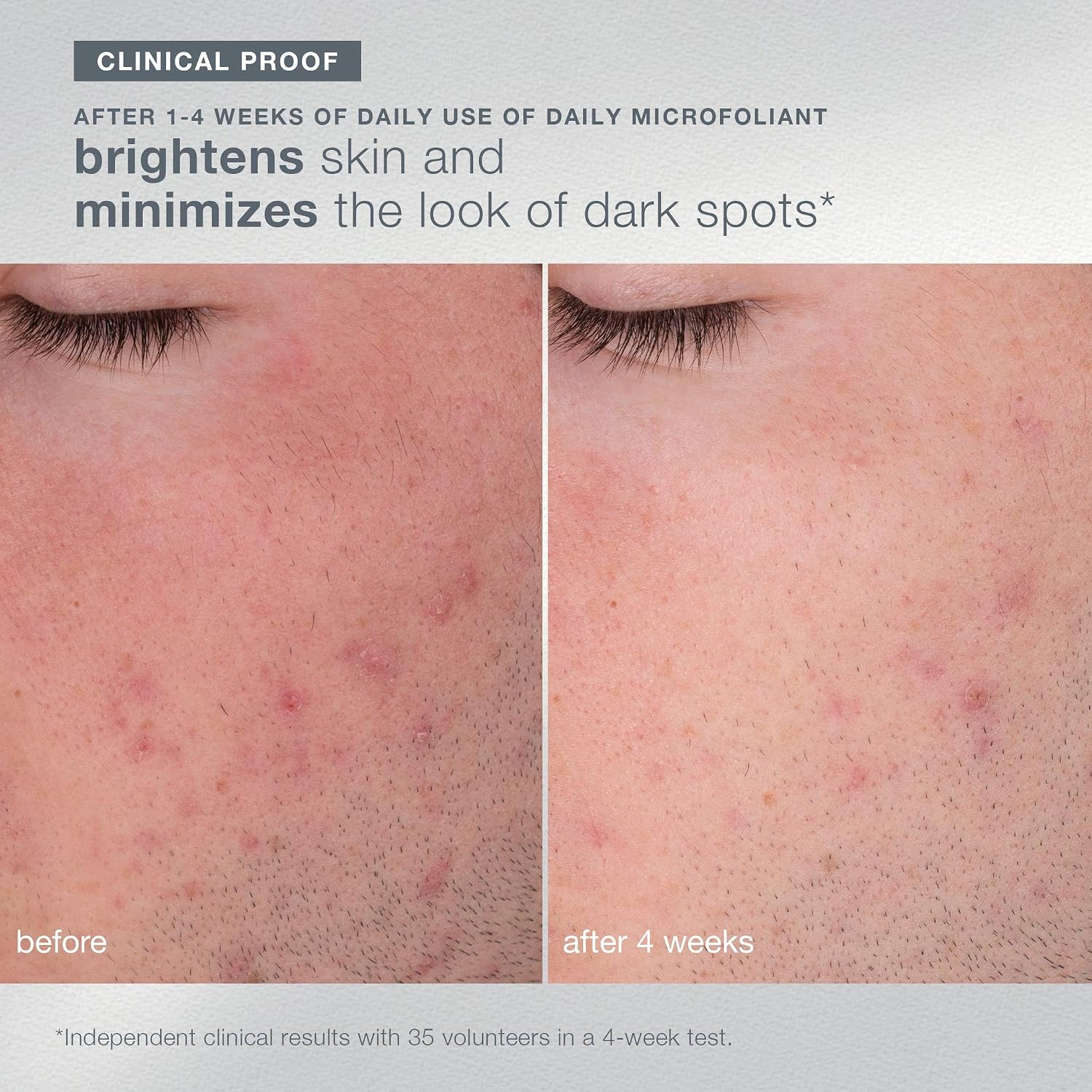 Dermalogica Your Moment of Expertise – Expert Level Skin Care Routine Set Includes 6 Products, Headband, Gua Sha, Fan Brush