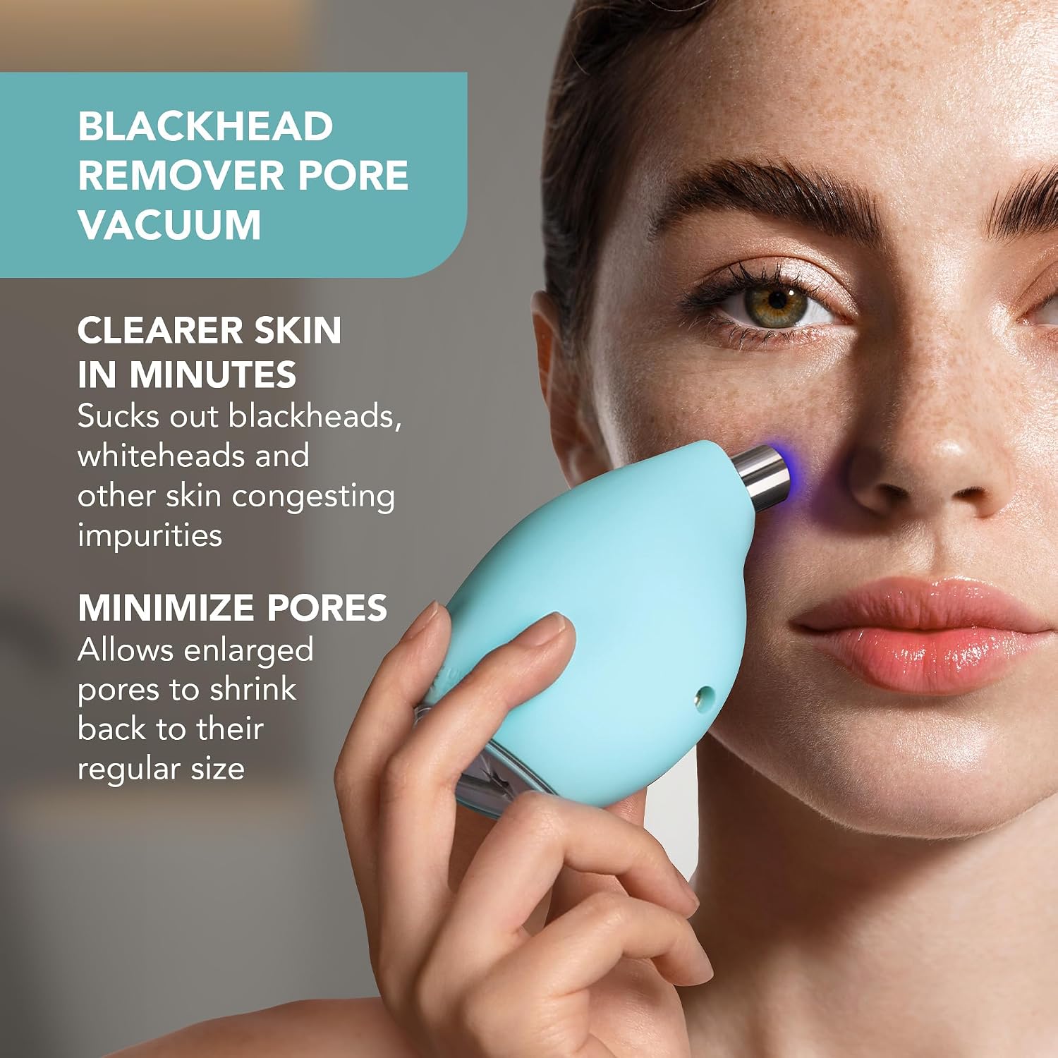 FOREO KIWI Whitehead & Black Head Remover for Face - Facial Skin Care Tools - Blackhead Extractor for Face & Nose - No Pore Strips Suction - Quick & Effective Blackhead Remover Device