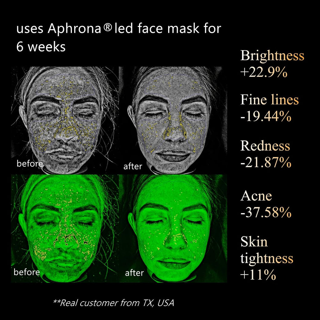 Aphrona Halo Led Face Mask, Led Light Therapy for face, Facial and Neck Skin Care Mask, Blue Light Red Light for Acne treatment Wrinkle Reduce, 807 led chips