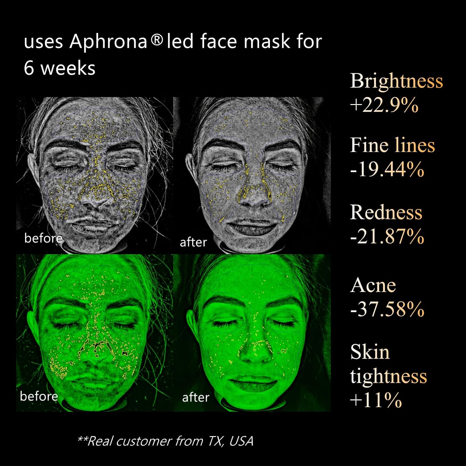 Aphrona Halo Led Face Mask, Led Light Therapy for face, Facial and Neck Skin Care Mask, Blue Light Red Light for Acne treatment Wrinkle Reduce, 807 led chips