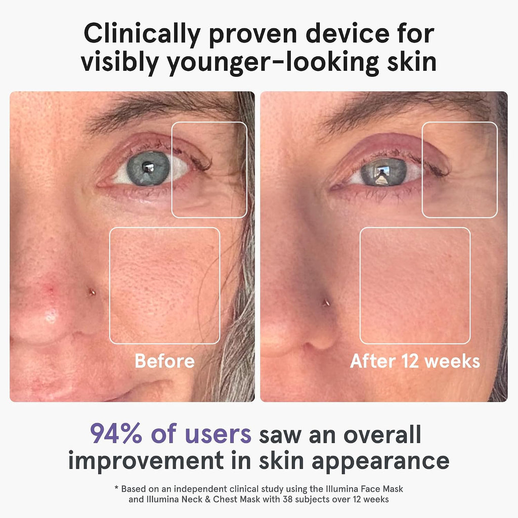 iRestore LED Face Mask for Youthful Skin, Red Light Therapy for Face, Red, Blue & Infrared Therapy for Wrinkles, Fine Lines, Dark Spots with 360 LEDs, Skincare Device for Women & Men