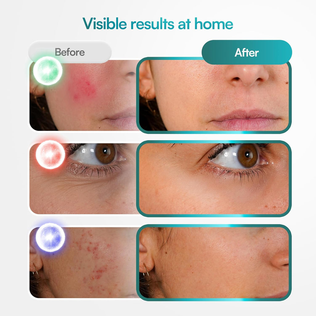 Red Light Therapy for Face, Wireless LED Face Mask Light Therapy, 9 Modes, 850nm NIR & 630nm Red, 2500mAh Rechargeable, 3D Facial Fit, At-Home Skin Care