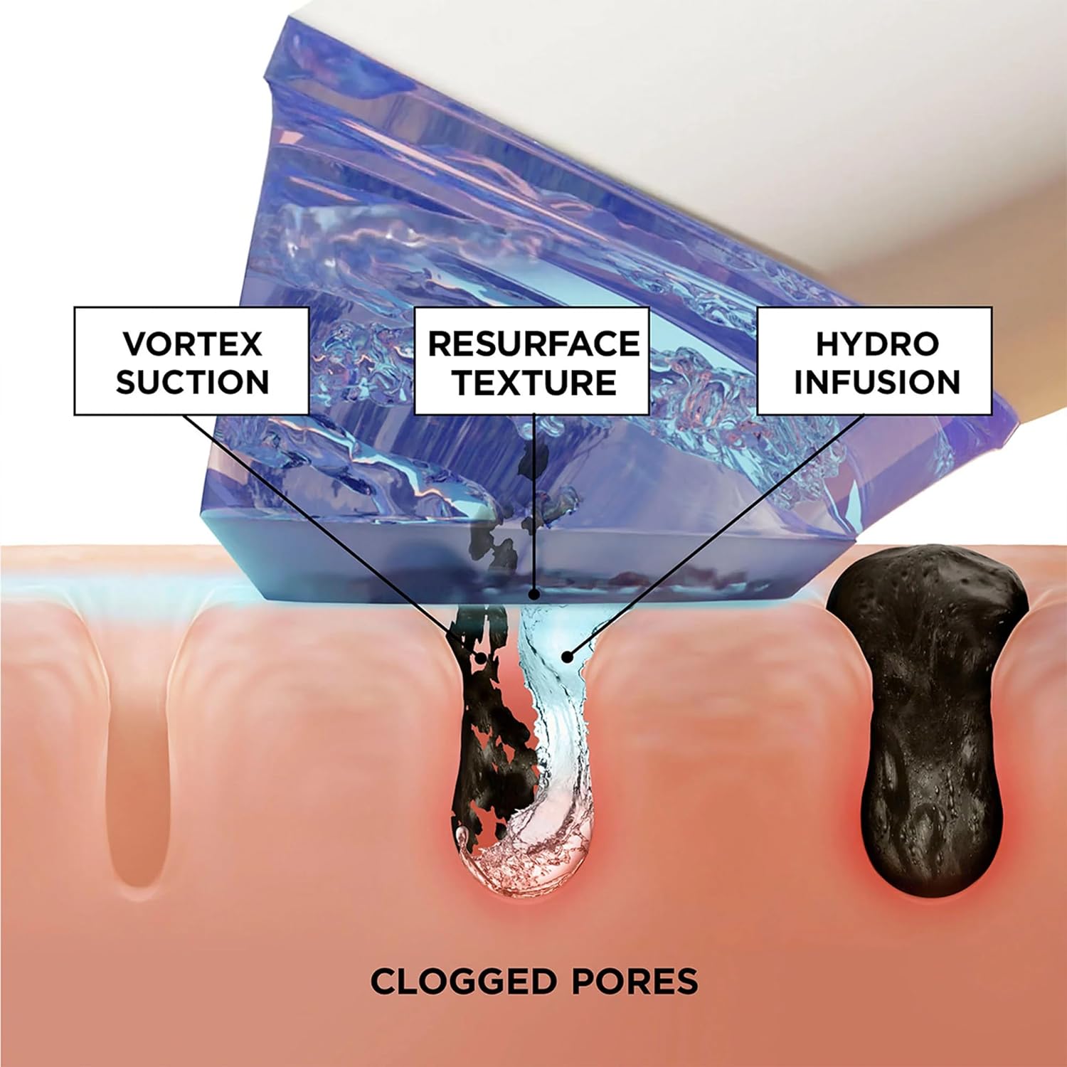 BeautyBio GLOfacial Hydro-Infusion Deep Pore Cleansing + Blue LED Clarifying Set: Tool + Concentrate