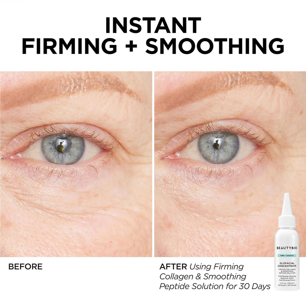 BeautyBio GLOfacial Hydro-Infusion Deep Pore Cleansing + Blue LED Clarifying Set: Tool + Concentrate