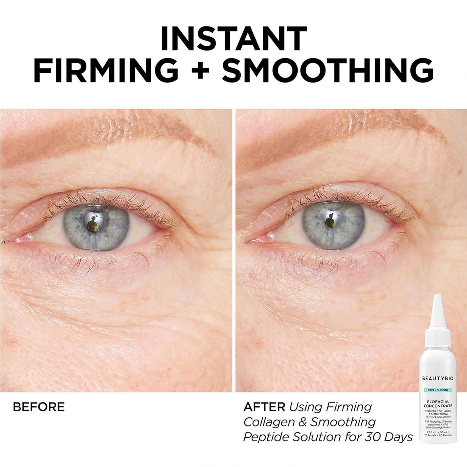 BeautyBio GLOfacial Hydro-Infusion Deep Pore Cleansing + Blue LED Clarifying Set: Tool + Concentrate