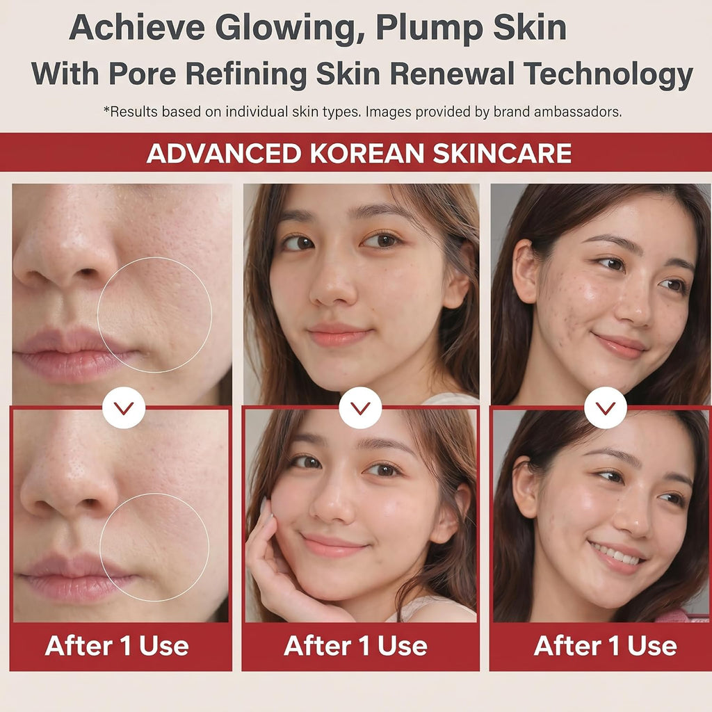 Surgia Pro Korean 4 in 1 Beauty Device - Facial Device, Face Lifting, Pore Care, Collagen Care, V Line Care, Facial Massager, Home Skincare Device, Skin Boost Device