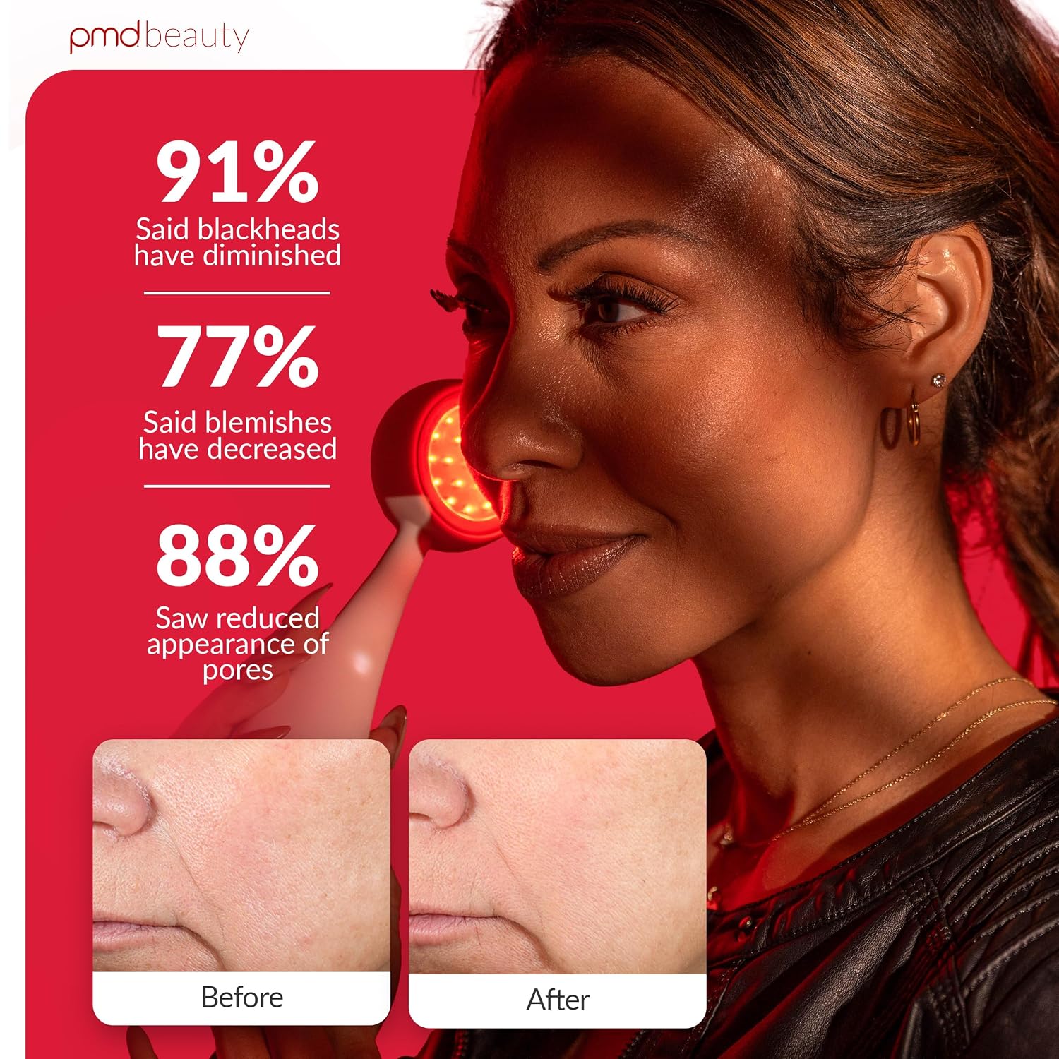 Clean, Acne, and Redvolution - Electric Facial Cleansing Brush, Smart Facial Device with Silicone Brush & Anti-Aging Massager, Red and Blue LED Light